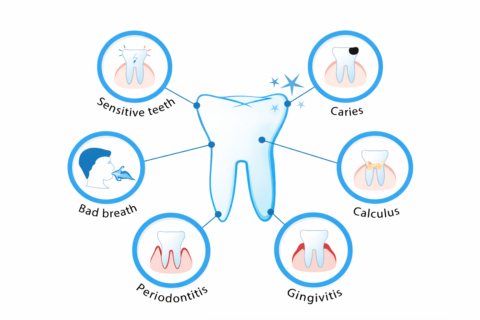 Effects of tea and coffee on teeth